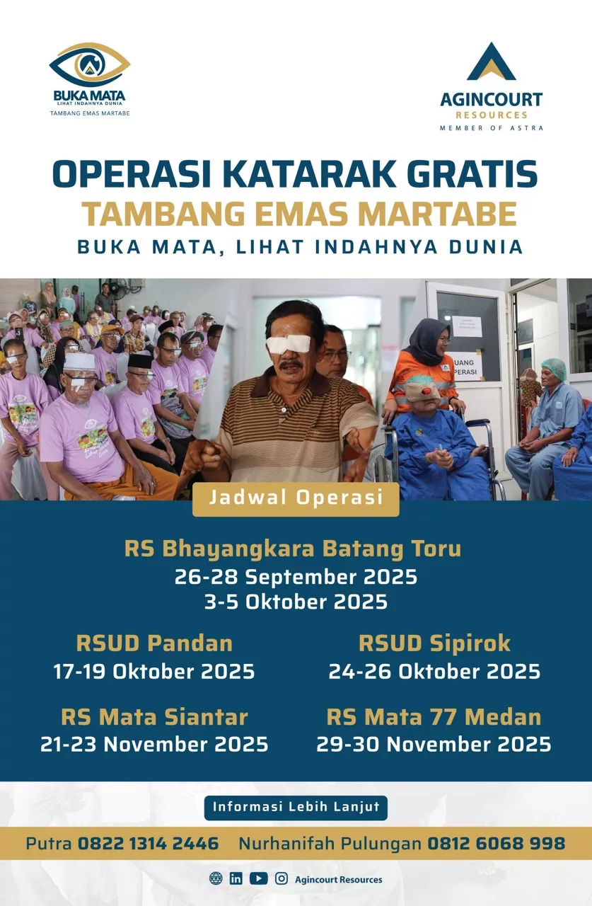Jadwal Operasi Katarak Tambang Emas Martabe